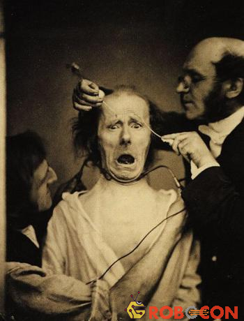 Một bác sĩ khoa thần kinh đang nghiên cứu biểu hiện trên khuôn mặt bằng cách sử dụng điện trên một bệnh nhân.