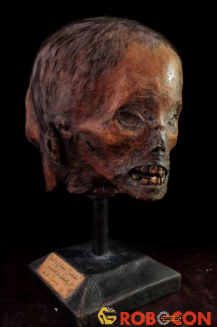 Chiếc sọ 2 mặt được trưng bày trong viện bảo tàng