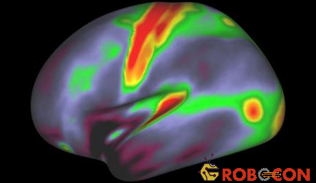 Một hình ảnh khác cung cấp thông tin về các vị trí giàu myelin (đỏ, vàng) hay ít myelin (xanh, tím).