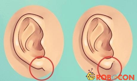 Những sự thật thú vị về đôi tai mà hầu hết mọi người đều không biết