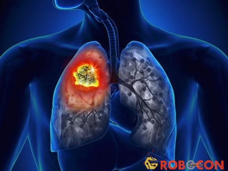 Nếu trong phổi không có không khí, lá phổi sẽ vỡ tung. 