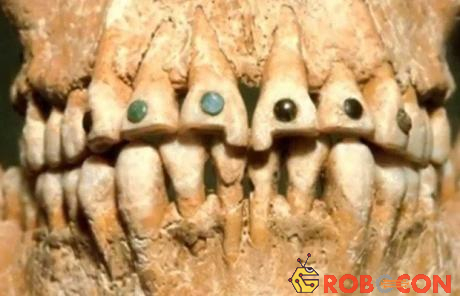 Bộ răng của người Ai Cập cổ.