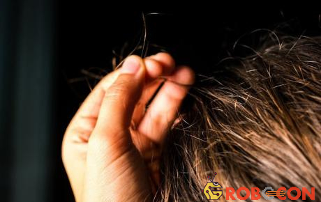 Nghiện nhổ tóc là một dấu hiệu phổ biến nhất ở những người mắc hội chứng Trichotillomania.