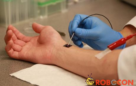 Con chip tái tạo tế bào trên tay bệnh nhân.