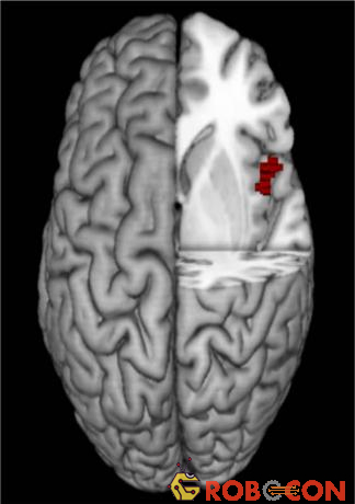 Vị trí insula trong não.