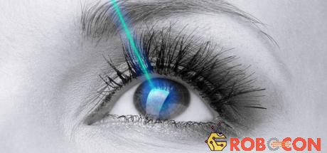  SmartSurfACE, phương pháp này được mệnh danh là “phẫu thuật mắt mà không cần chạm vào mắt”.