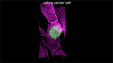 Đây là hình ảnh của một tế bào ung thư đang di chuyển trong mạch máu, tìm cách bám vào đâu đó
