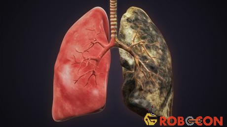 Hàm lượng CKAP4 là cao hơn đáng kể ở những bệnh nhân bị ung thư phổi so với những người khỏe mạnh.