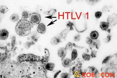 Virus HTLV-1. 
