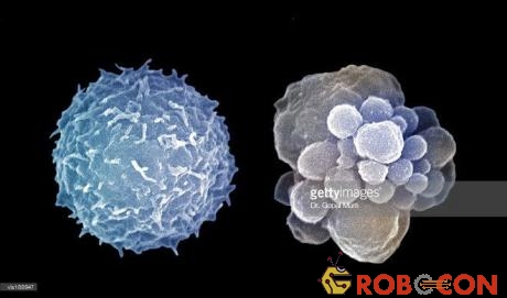 Tế bào bạch cầu khi khỏe mạnh (bên trái) và khi nó đi vào quá trình tự sát apoptosis.