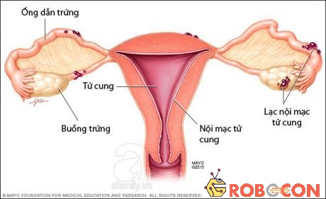 Lạc nội mạc tử cung thường phổ biến ở nữ giới trong độ tuổi sinh sản và ít gặp ở những phụ nữ đã mãn kinh.