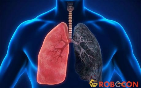 Những người có nguy cơ bị ung thư phổi nên tầm soát sớm kể cả khi chưa có triệu chứng.