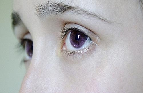 Bạn đã từng thấy người nào có đôi mắt màu tím hay chưa?