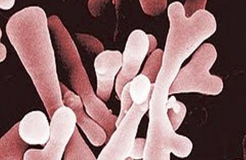 Những điều bạn chưa biết về vi khuẩn Bifidus