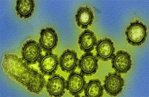 Ngày càng nhiều virus chết người lan ra khắp thế giới, và lý do thật chẳng dễ chịu chút nào
