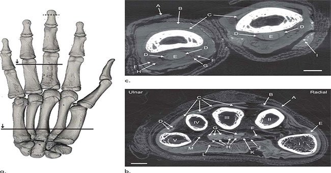 Kỹ thuật chụp ảnh hé lộ từng mạch máu bên trong xác ướp