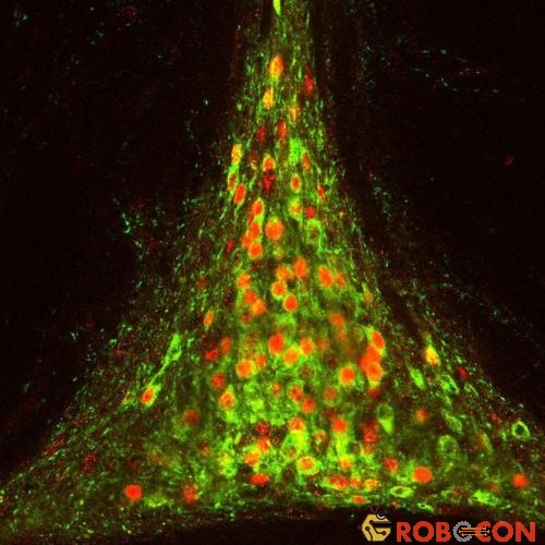 Các nơ-ron thần kinh (màu đỏ) trong não phản ứng với cơn khát.